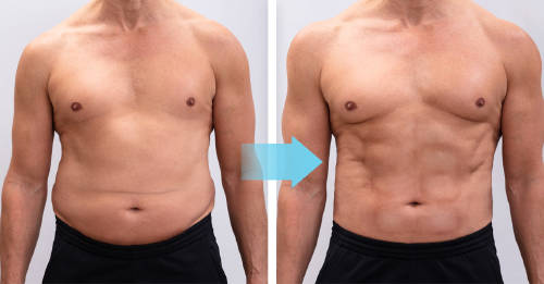 perdio 29 kg 21 minutos ejercicio perdio 29 kg 21 minutos ejercicio