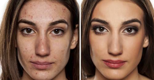 Así es como la contaminación envejece tu cara y lo que puedes hacer para combatirla Así es como la contaminación envejece tu cara y lo que puedes hacer para combatirla