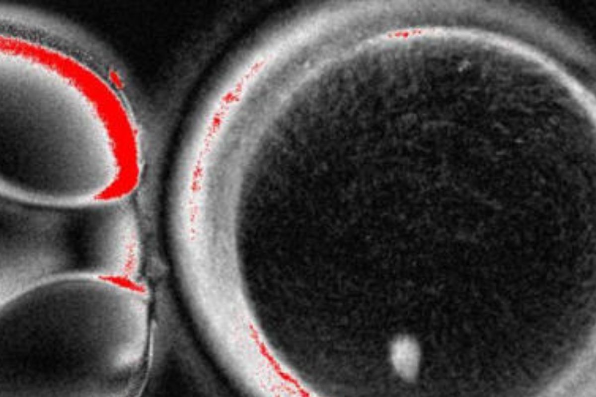 Consiguen por primera vez generar óvulos humanos potencialmente fecundables a partir de células de la piel. (msn.com)