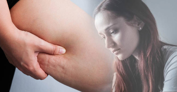 celulitis significado biodescodificación celulitis significado biodescodificación