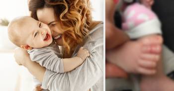 Síndrome del torniquete: este bebé casi pierde un dedo por un cabello de su madre