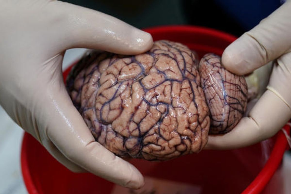 Imagen de archivo de un banco de cerebros humanos en Nueva York (Estados Unidos).© CARLO ALLEGRI (Reuters / ContactoPhoto)