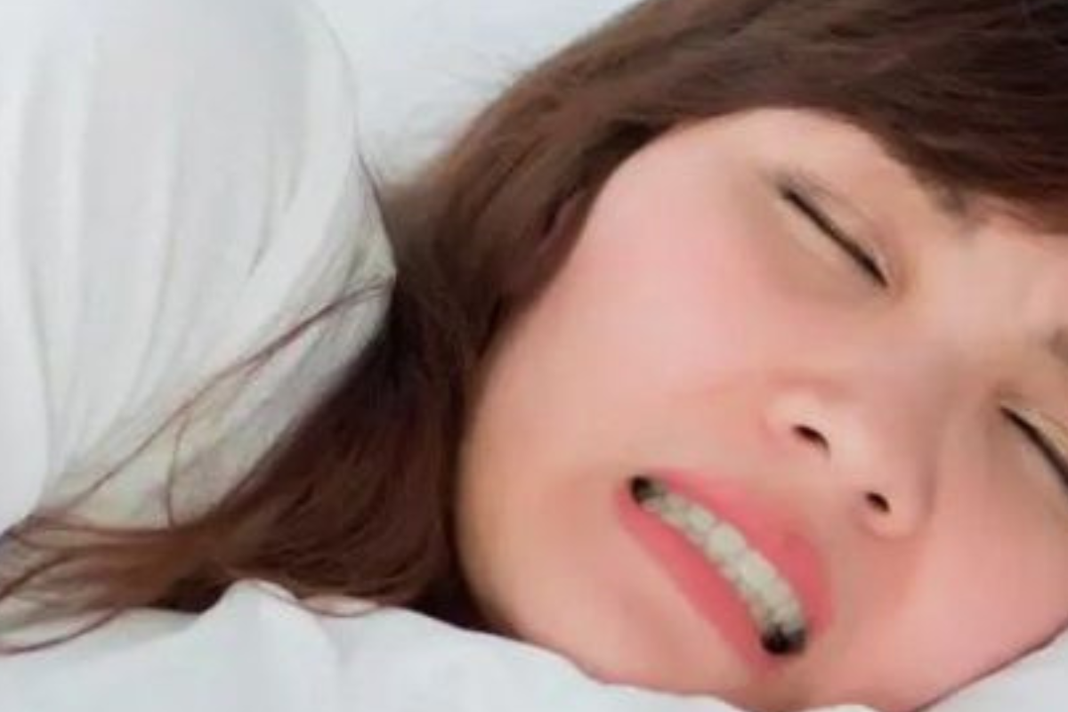 bruxismo El bruxismo, según la biodescodificación (Foto: Pinterest)