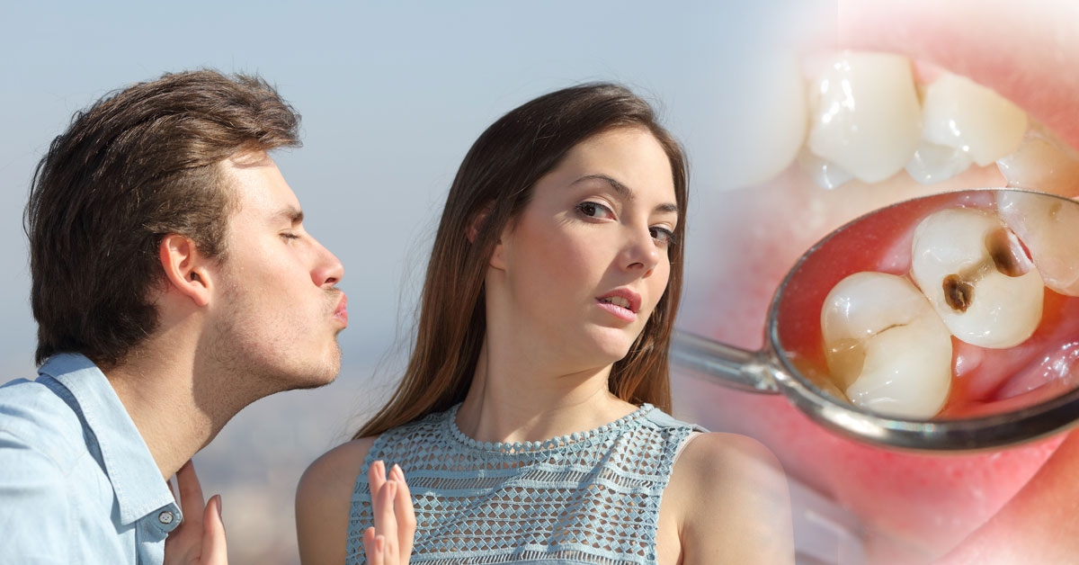 Razones por las que tu pareja puede contagiarte las caries Razones por las que tu pareja puede contagiarte las caries