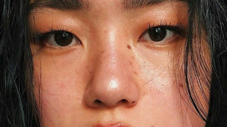 lunares Comprender el significado detrás de un lunar puede ayudarte a explorar emociones reprimidas o patrones heredados