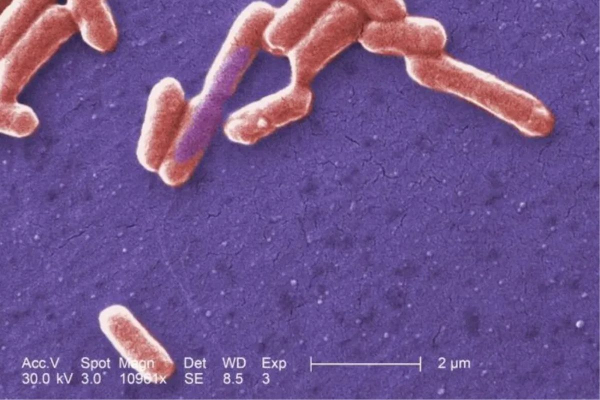 Escherichia coli al microscopio. Fuente: Wikipedia/muyinteresante.okdiario.com