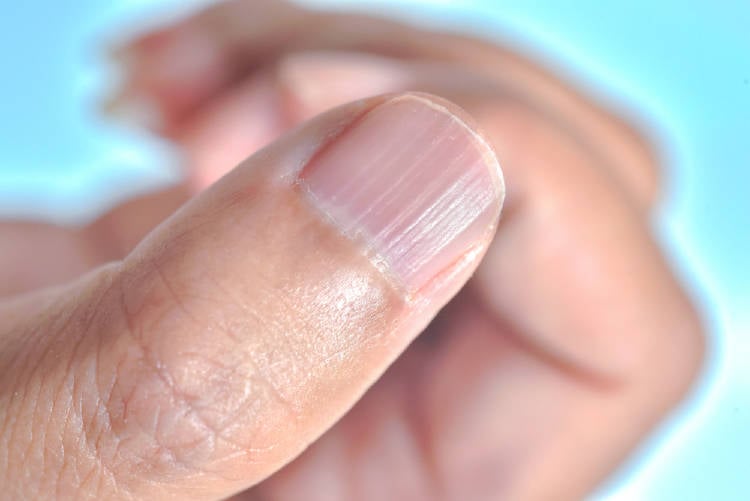 lineas en las uñas Por qué salen líneas en las uñas y cómo eliminarlas naturalmente