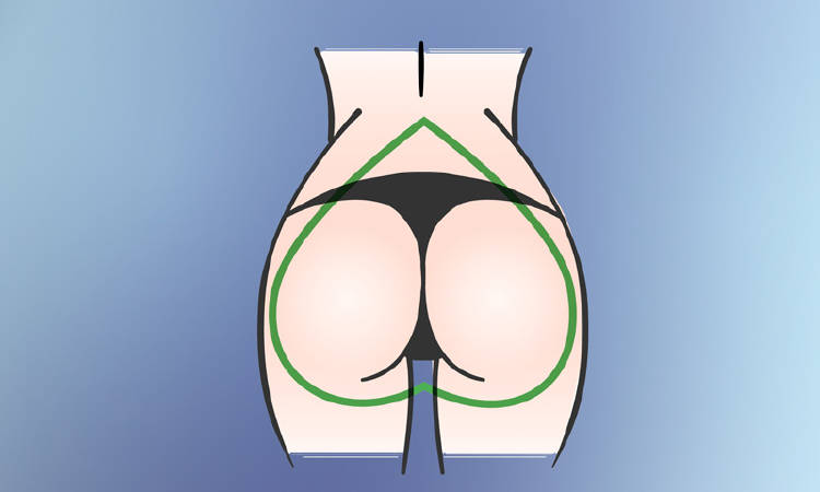 gluteos-corazon forma de gluteos corazon