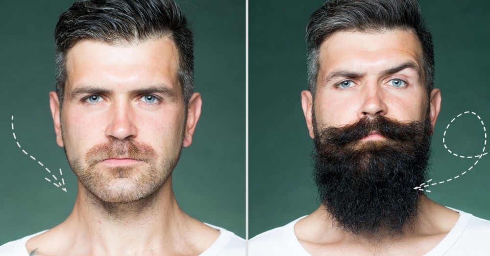 crecimiento de la barba