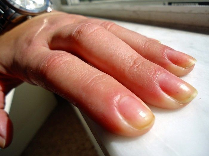 uñas uñas