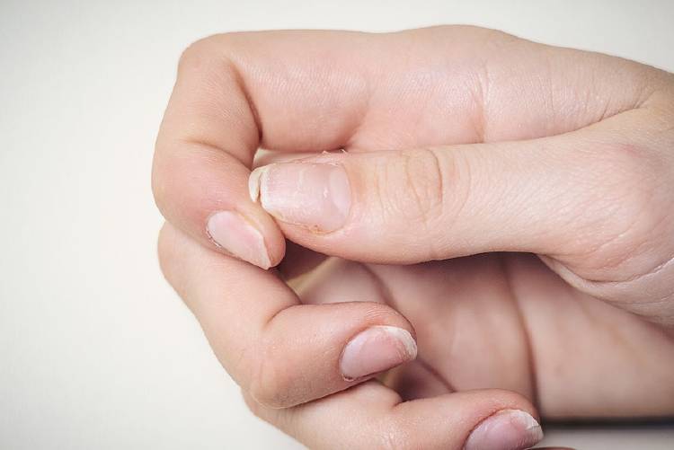 uñas quebradizas uñas quebradizas