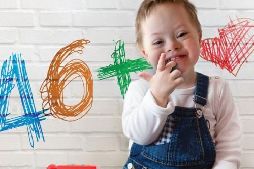 sindrome down Imagen: Pinterest