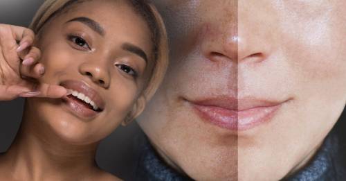 Los dermatólogos explican las 10 mejores vitaminas para tu piel