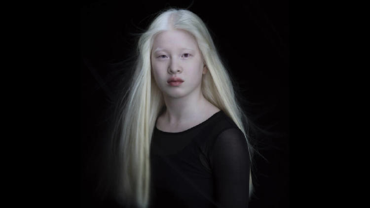 xueli abbing xueli abbing