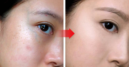 Gua Sha: lo que debes saber sobre este método chino para tener el cutis suave