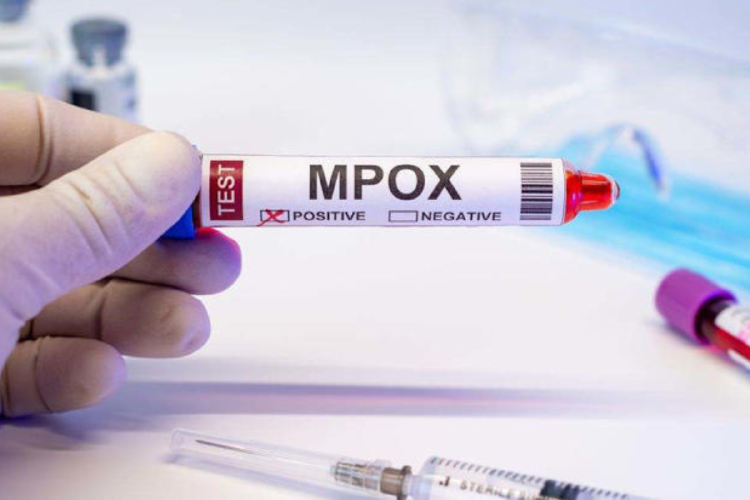 viruela del mono La OMS advierte a nivel mundial de la reaparición de una enfermedad muy temida del pasado. (Fuente: MSN)