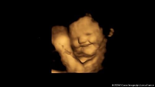 63212401 303 63212401 303