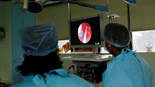 Hongo negro Hongo negro