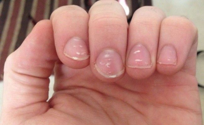 uñas uñas