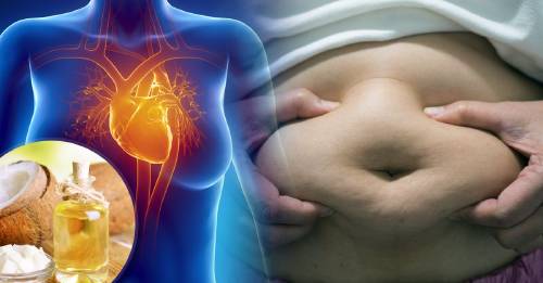 ¿El aceite de coco es bueno o malo? Al fin un estudio terminó con la polémica ¿El aceite de coco es bueno o malo? Al fin un estudio terminó con la polémica