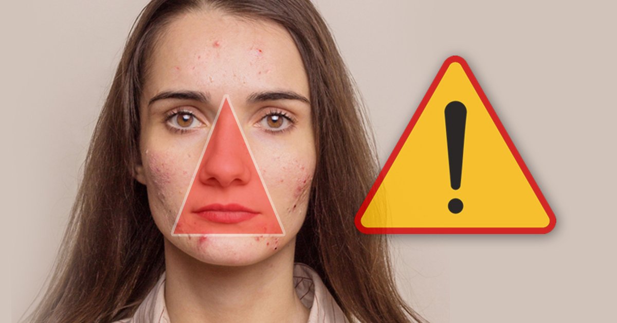 Esta es la raz&oacute;n por la que nunca debes tocar las espinillas del &ldquo;Tri&aacute;ngulo de la Muerte&rdquo;