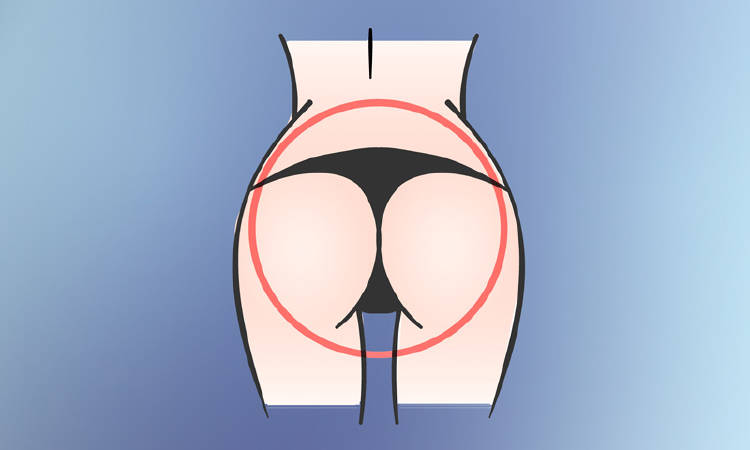 gluteos-redondos forma gluteos redondos