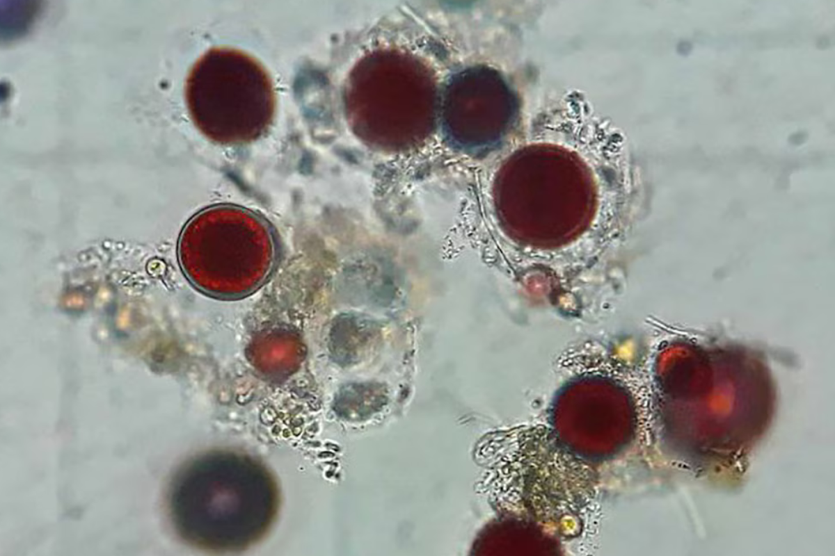 alga Detalle del alga en el microscopio. (Foto: Infobae)