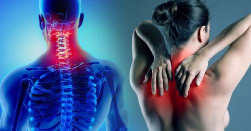 El dolor de cuello frecuente puede ser un indicador de una enfermedad mucho más seria