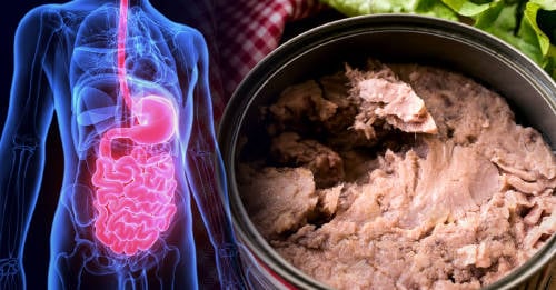 Comer atún en lata puede ocasionar estas enfermedades | Bioguia