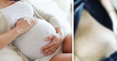 Esta mujer mostró con orgullo su abdomen luego de tener cuatrillizos y le llovieron los aplausos