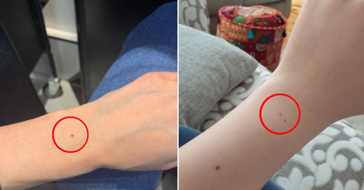 Lunar en la muñeca Lunar en la muñeca