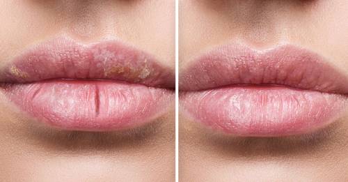 Este es el truco natural y definitivo para acabar con los labios resecos Este es el truco natural y definitivo para acabar con los labios resecos