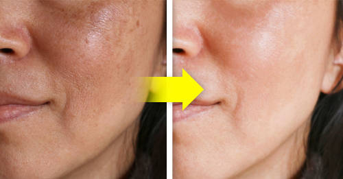 recetas naturales piel luminosa recetas naturales piel luminosa