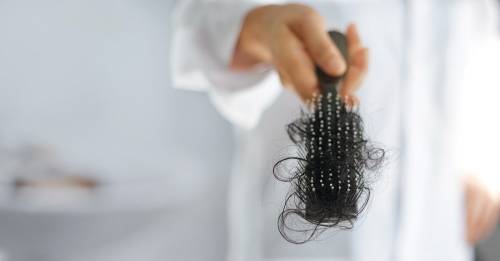 calvicie alopecia ¿Qué significa y cómo decodificar la caída del cabello?