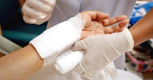 paso a paso curar herida infectada paso a paso curar herida infectada