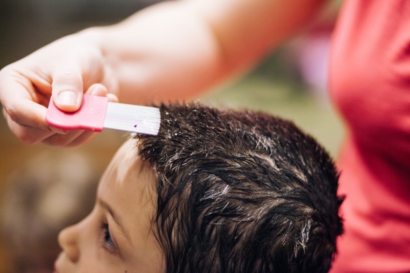 como erradicar piojos y liendres violate herir el cabello