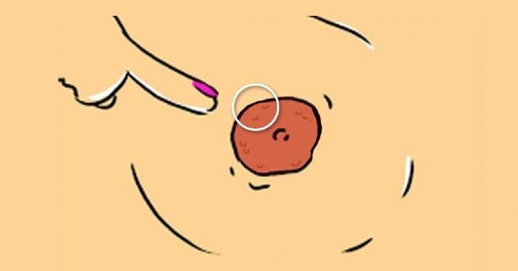 Bolitas En El Pezon Que Son Y Por Que Salen Bioguia Bolitas En El Pezon Que Son Y Por Que Salen Bioguia