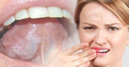 Si tu lengua tiene esto, deberías prestar mucha atención Si tu lengua tiene esto, deberías prestar mucha atención