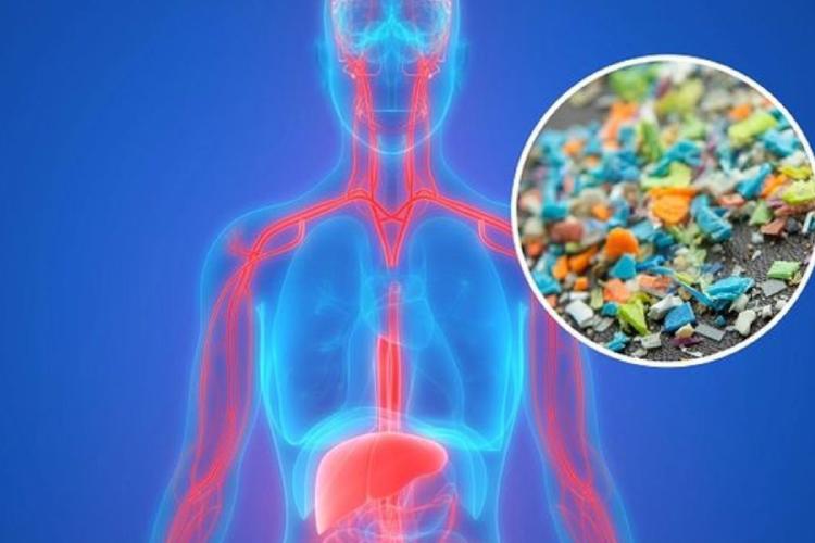 microplasticos Imaginá estar en tu casa o manejando al trabajo, respirando con normalidad. Sin darte cuenta, podrías estar inhalando hasta 68.000 microplásticos al día. (PINTEREST)