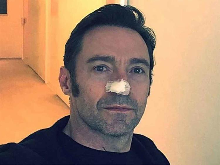 hugh jackman hugh jackman