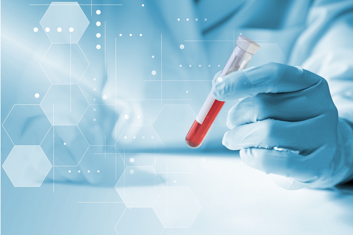 análisis de sangre análisis de sangre