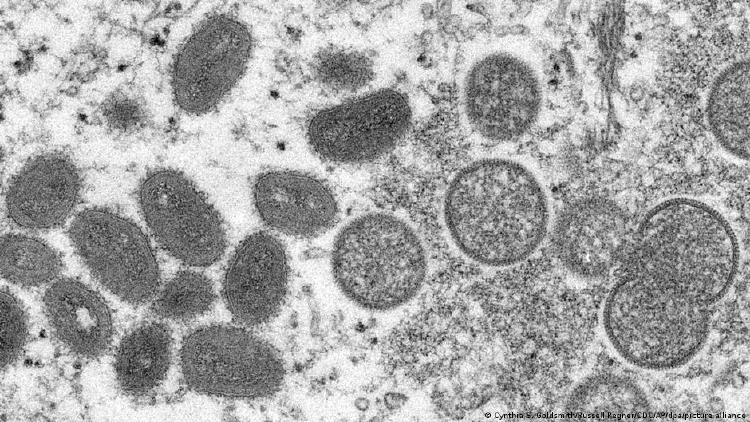 Virus que causa la viruela de los monos a través del microscopio