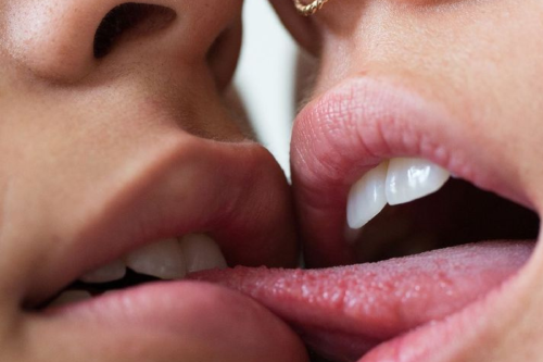 virus del beso Se transmite de forma muy similar al \"virus del beso\" (Epstein Barr) y puede permanecer en el cuerpo durante toda la vida sin dar síntomas. (Imagen: Pinterest)