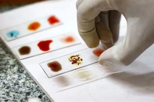 sangre Solo se conocen 50 personas en el mundo con el tipo de sangre Rh nulo. (bbc.com)