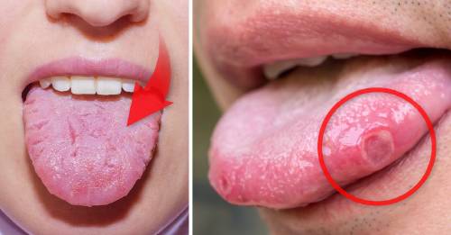 Esto es todo lo que tu lengua dice sobre tu salud
