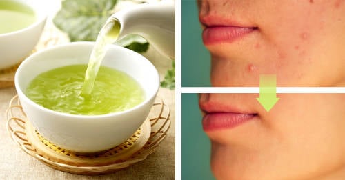te verde aliado acne te verde aliado acne