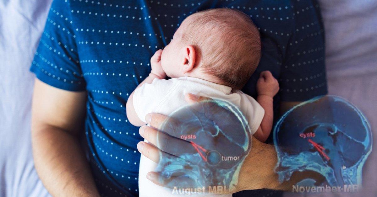 El Papa besó a su hija enferma en la cabeza y lo que ocurrió 2 meses después los dejó atónitos El Papa besó a su hija enferma en la cabeza y lo que ocurrió 2 meses después los dejó atónitos