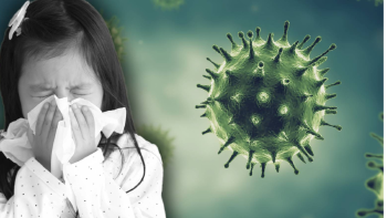 virus respiratorio El virus sincicial respiratorio (VSR) es la principal causa de infecciones respiratorias agudas bajas (foto: www.univision.com)