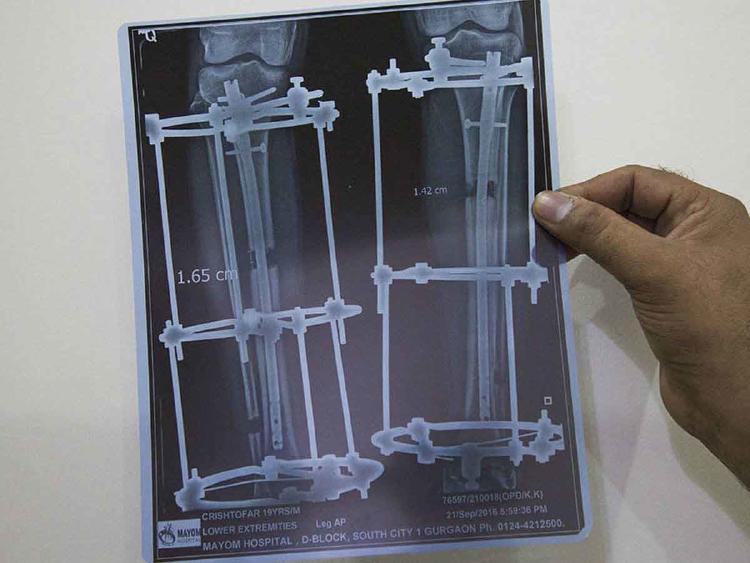CIRUGIA ESTATURA2 CIRUGIA ESTATURA2