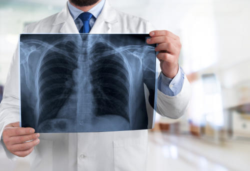 médico radiografía neumonia
